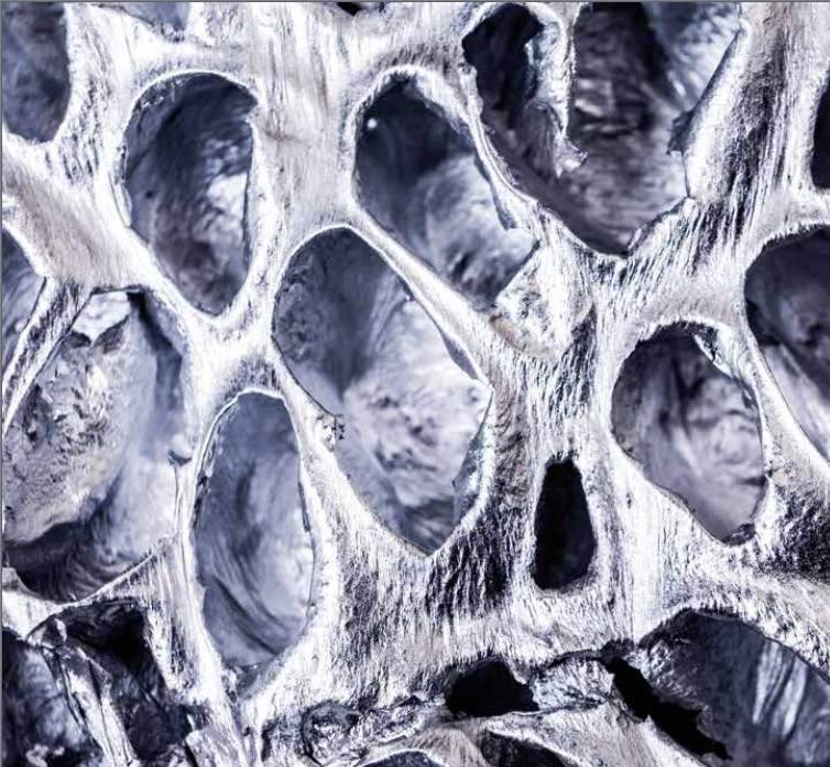 Open Cell Aluminium Foam composite (OCAF)